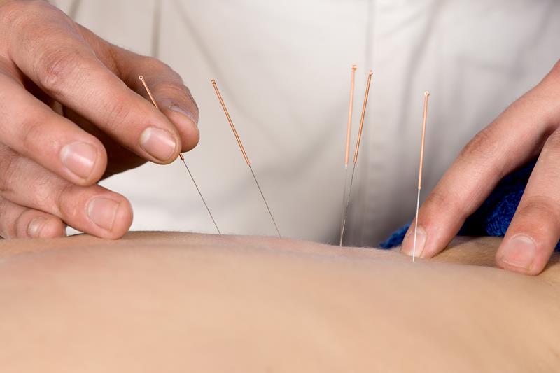 Acupuncture Winnipeg, MB RN J